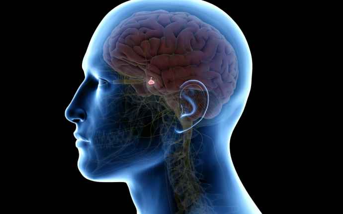 Aivolisäkkeen häiriöiden taustalla on useimmiten hormonituotantoa häiritsevä kasvain