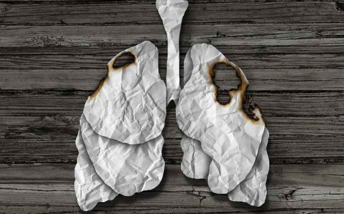 Keuhkosyöpä on maailman yleisin syöpä – valtaosa tapauksista tupakan aiheuttamia