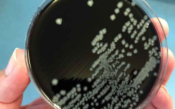 Kampylobakteeri-infektion voi saada pilaantuneesta ruoasta