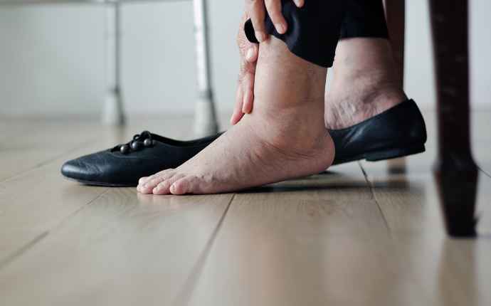 Diabetespotilas, muistatko tutkia jalkasi päivittäin?