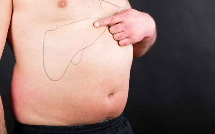 Joka neljäs aikuinen kärsii rasvamaksasta – tunnetko riskitekijät?