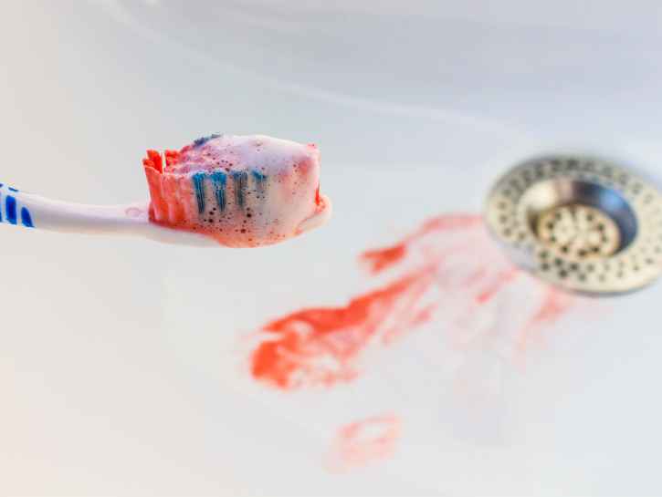 Tiesitkö? Ientulehdus voi johtaa jopa hampaiden irtoamiseen