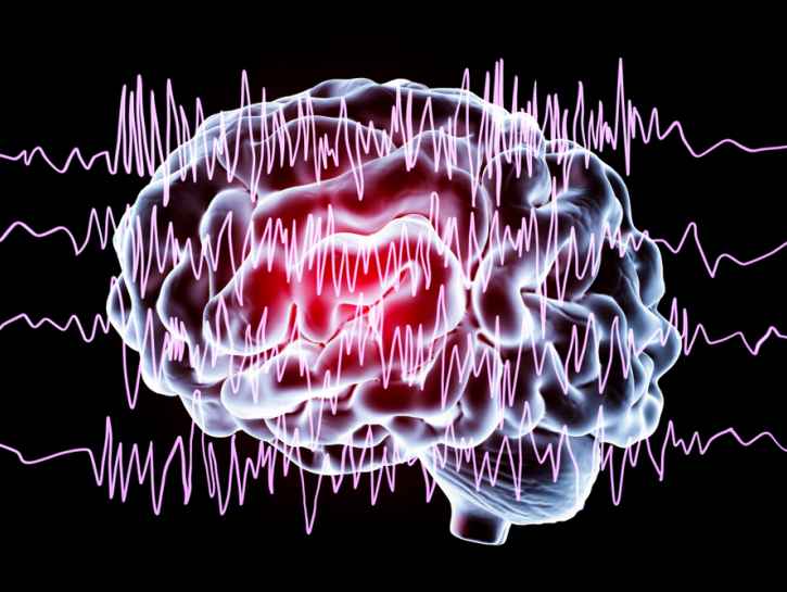 Epilepsian oireet ovat yksilöllisiä