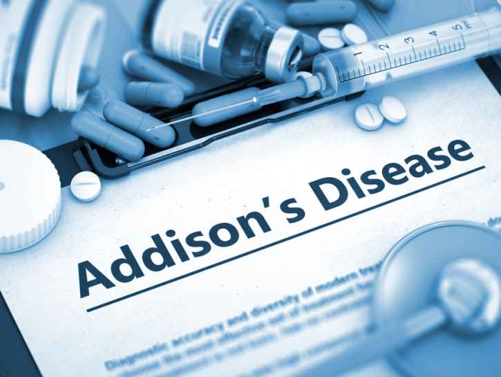 Addisonin tauti puhkeaa pääosin autoimmuunireaktion seurauksena 