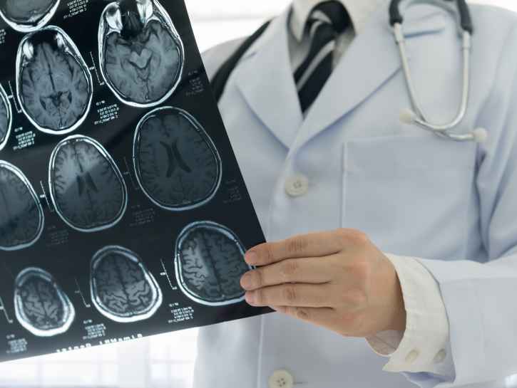 Video: Tiedätkö, miltä aivoverenkiertohäiriön aiheuttamat oireet näyttävät?