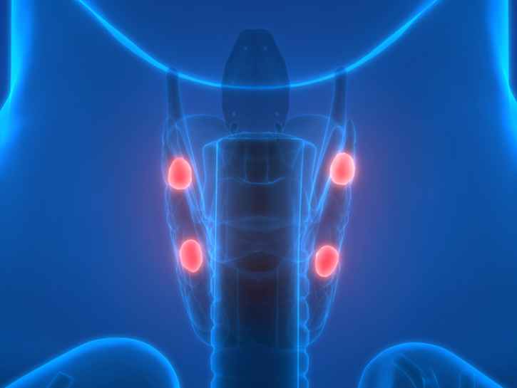 Lisäkilpirauhasen liikatoiminnan oireet voivat olla niukkoja – sairaus havaitaan usein sattumalta
