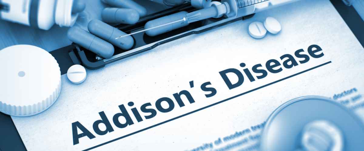 Addisonin tauti puhkeaa pääosin autoimmuunireaktion seurauksena 