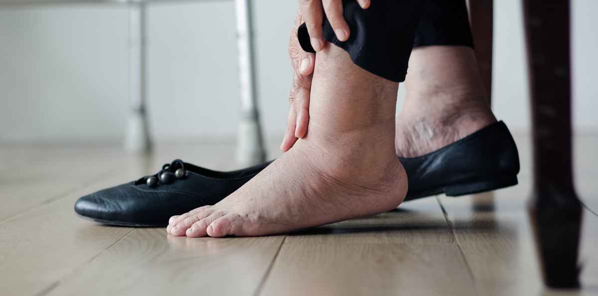 Diabetespotilas, muistatko tutkia jalkasi päivittäin?