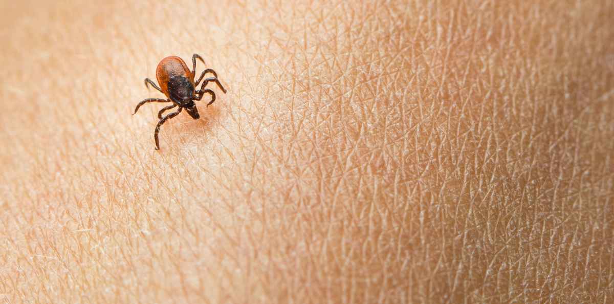 Vältä yleiset virheet – näin poistat punkin iholta oikeaoppisesti