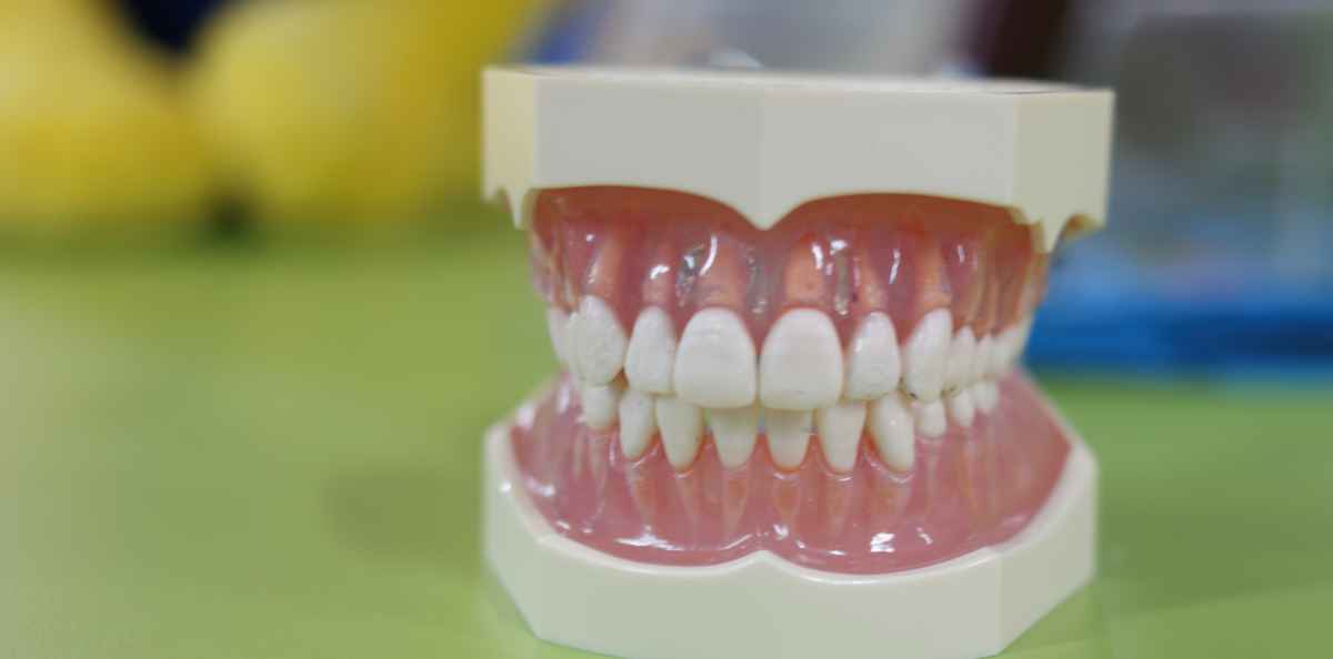 Narskuttelu kipeyttää lihaksia ja kuluttaa hampaita – mutta voiko bruksismista olla hyötyä?