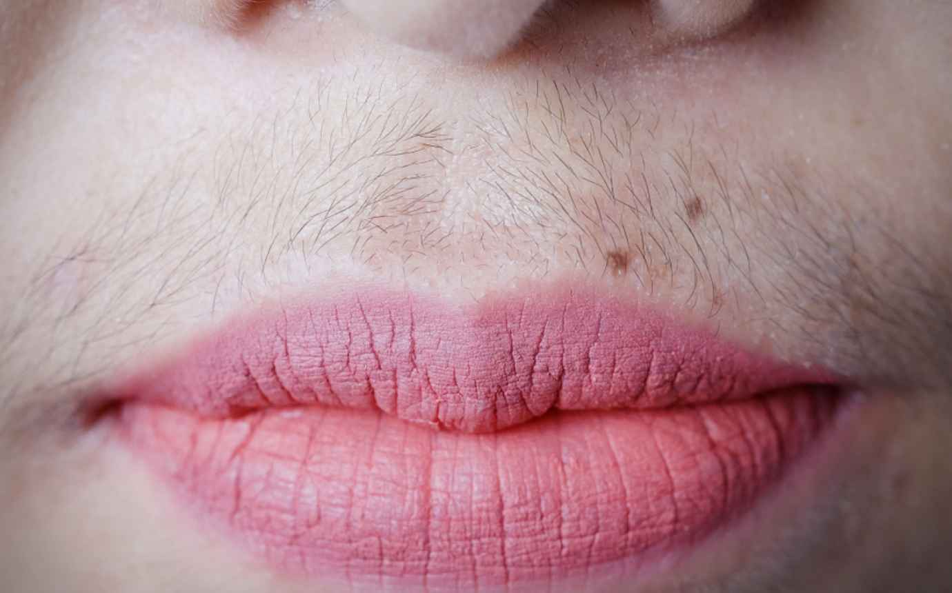 Усы тонкие над губой. Женские усики. Усики у женщин. Усатые губы. Улыбка краем губ.
